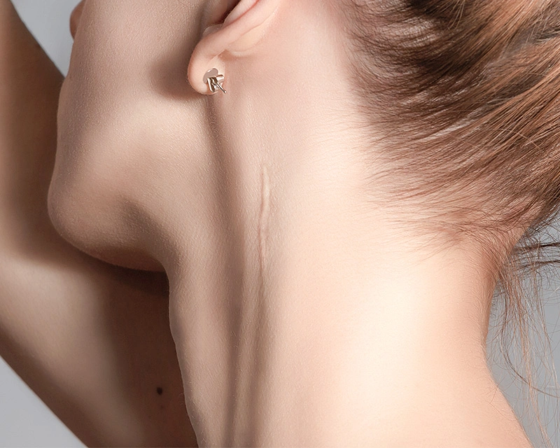 Frau mit Opekaris am Hals